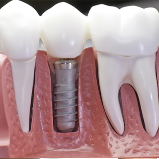 Soonam's Dental Clinic, Piravom